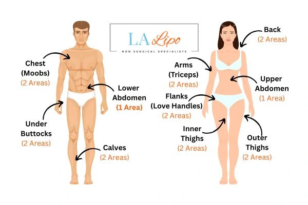 LA LIPO Cryolipolysis Areas Lyndhurst