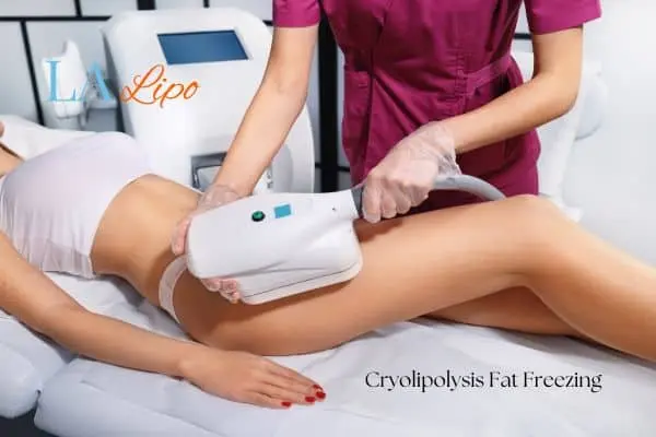 Woman receiving coolsculpting Lyndhurst treatment on her thighs