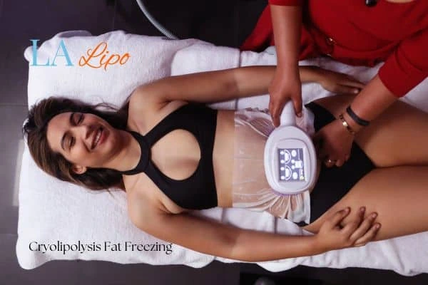 woman getting cryolipolysis Lyndhurst