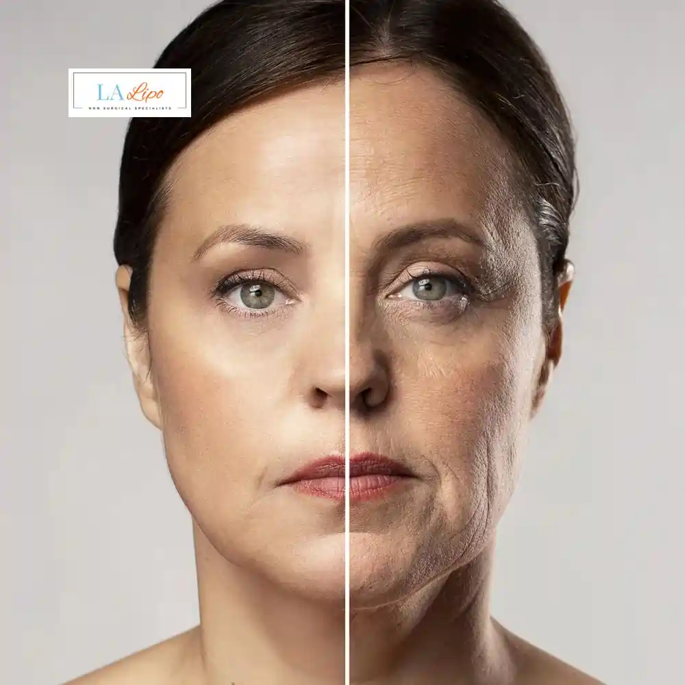 How Can You Tell If Non-Surgical Skin Tightening Is Right for You Lyndhurst?
