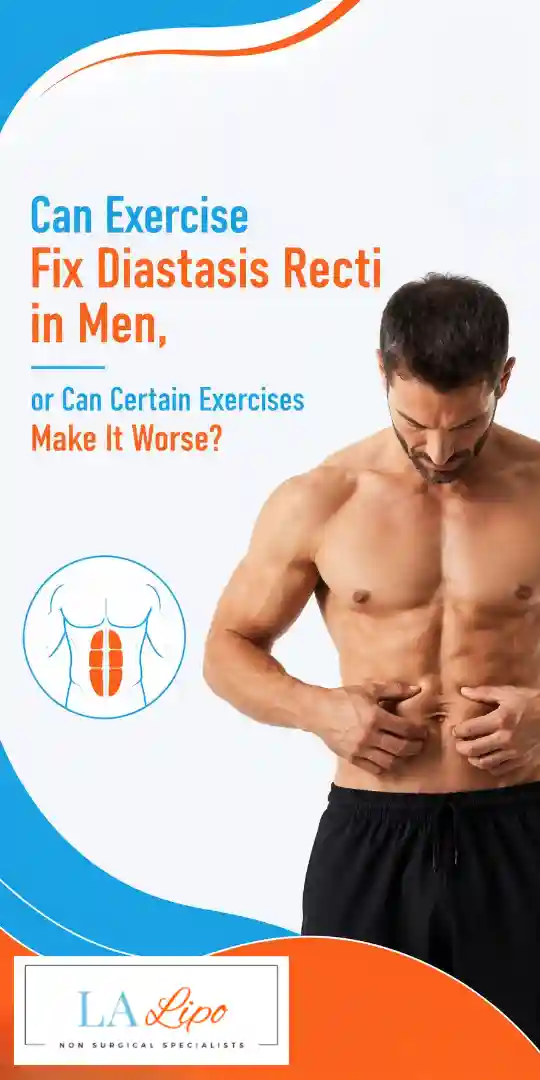 Can Exercise Fix Diastasis Recti in Men, or Can Certain Exercises Make It Worse Lyndhurst?